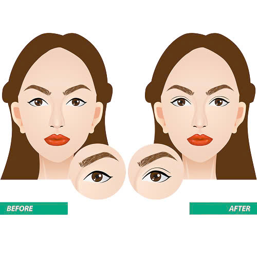 cat-mi-full-bo-da-du-co-dau-khong-bi-quyet-giup-ban-hoi-phuc-nhanh-it-sung