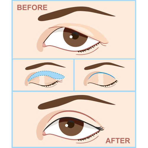 bat-mi-cat-mi-full-bo-da-trung-bao-lau-thi-lanh-va-dep-tu-nhien-nhu-mong-muon
