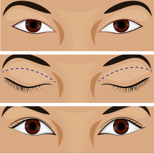 cat-mi-full-cho-mat-mot-mi-giai-phap-thay-mi-moi-cho-doi-mat-tuoi-tre-cuon-hut