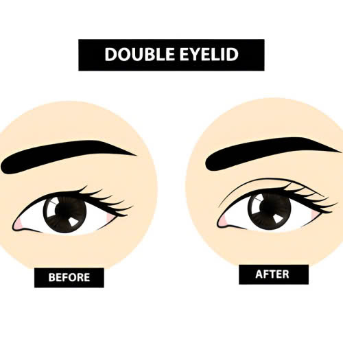 cat-mi-full-cho-mat-mot-mi-giai-phap-thay-mi-moi-cho-doi-mat-tuoi-tre-cuon-hut