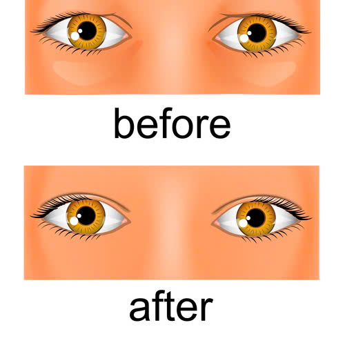 cat-mi-full-co-de-lai-seo-khong-va-cach-khac-phuc-hieu-qua