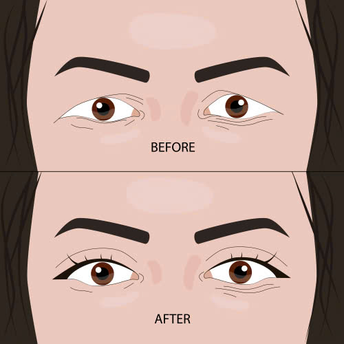 cat-mi-full-giu-duoc-bao-lau-va-cach-duy-tri-ket-qua