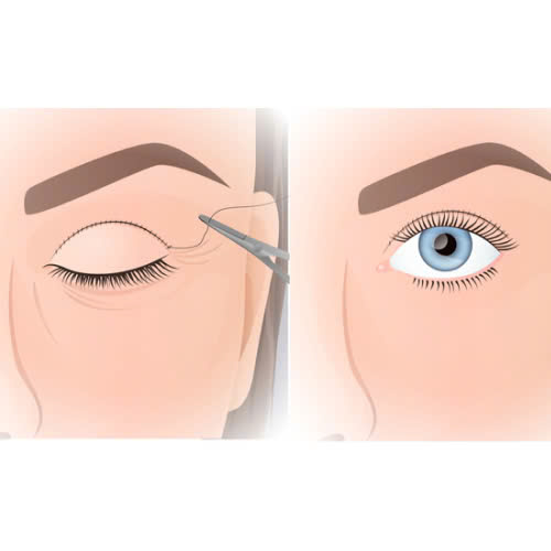 cat-mi-full-giup-mat-tre-trung-hon-khong-top-4-loi-ich-khien-phai-dep-me-man