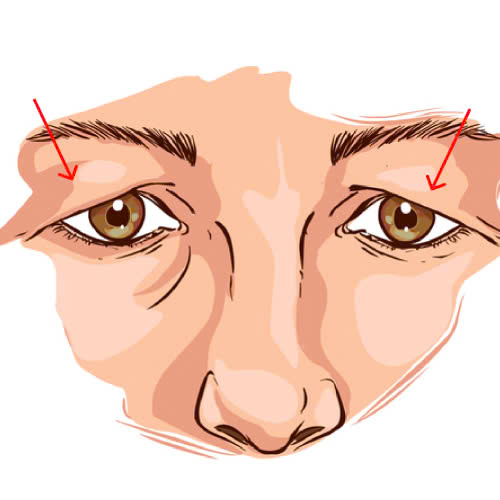 cat-mi-mat-cho-nguoi-lon-tuoi-quy-trinh-loi-ich-va-nhung-dieu-can-biet