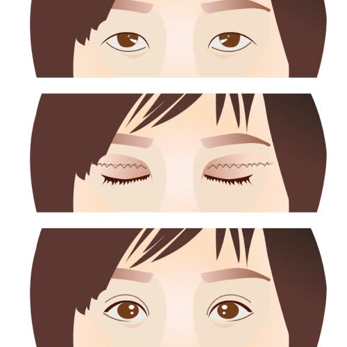 huong-dan-cham-soc-sau-cat-mi-full-bo-da-trung-dung-cach-de-giu-dang-mi-dep