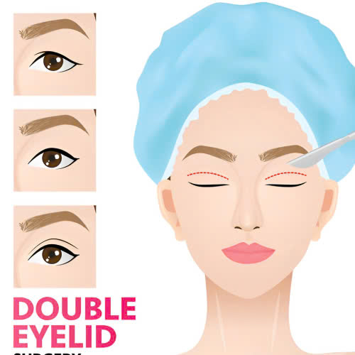 co-nen-cat-mi-full-bo-da-chung-khong-bat-mi-phuong-phap-giup-ban-tre-hoa-doi-mat