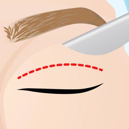 co-nen-cat-mi-full-bo-da-chung-khong-bat-mi-phuong-phap-giup-ban-tre-hoa-doi-mat