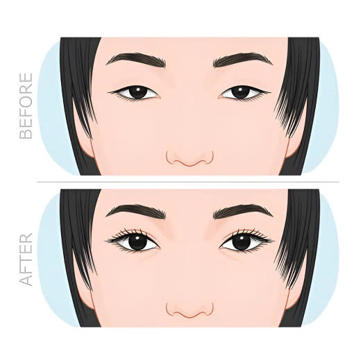 co-nen-cat-mi-full-bo-da-chung-khong-bat-mi-phuong-phap-giup-ban-tre-hoa-doi-mat