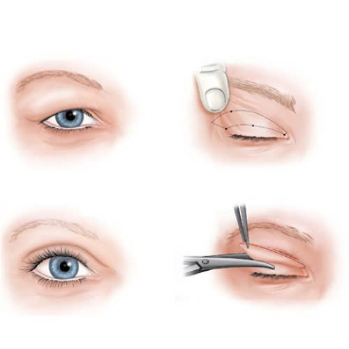 dia-chi-cat-mat-2-mi-full-uy-tin-huong-dan-chon-lua-va-nhung-dieu-can-biet