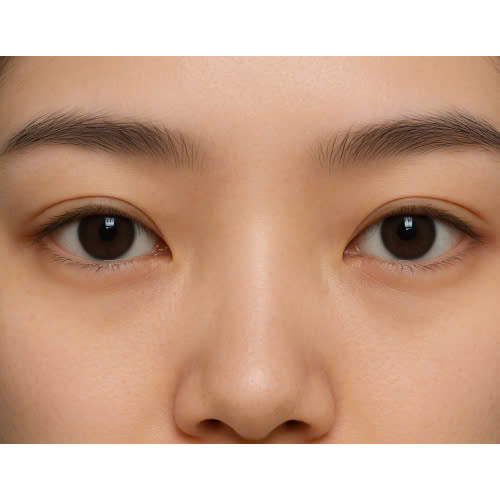 vi-sao-nen-tham-khao-hinh-anh-truoc-sau-tao-hinh-mat-trung-hoa-truoc-khi-quyet-dinh-thuc-hien