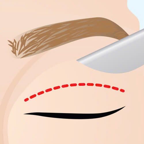 mat-trung-dong-co-giu-duoc-lau-khong-cung-tim-hieu-nhung-yeu-to-anh-huong-den-do-ben-cua-mat-trung-dong