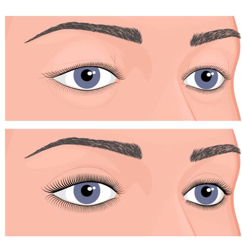 mat-trung-dong-hop-voi-khuon-mat-nao-de-guong-mat-them-sac-sao-cuon-hut