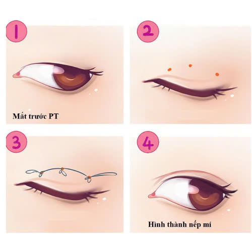 mat-trung-hoa-dep-khong-co-phu-hop-voi-khuon-mat-ban-khong