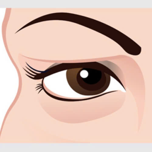 mi-mat-bi-sup-phai-lam-sao-nguyen-nhan-va-giai-phap-an-toan-hieu-qua