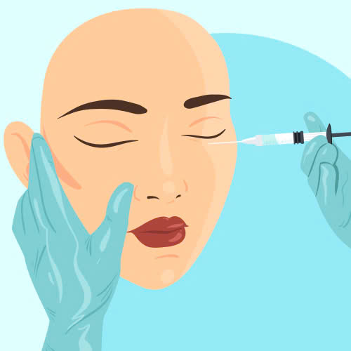 mi-mat-cuoi-bang-tiem-filler-giai-phap-tao-doi-mat-tuoi-tan-tre-trung-khong-can-xam-lan