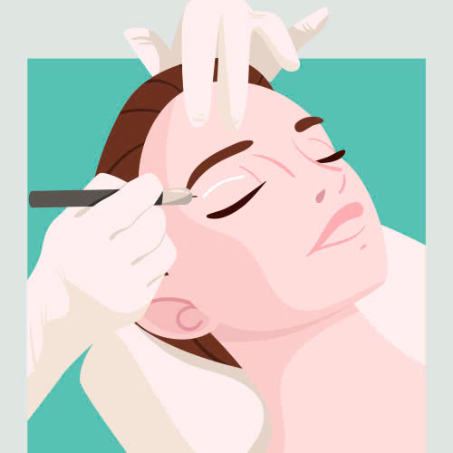 mi-mat-cuoi-dep-khong-uu-va-nhuoc-diem-ban-can-biet-truoc-khi-thuc-hien-phuong-phap-nay