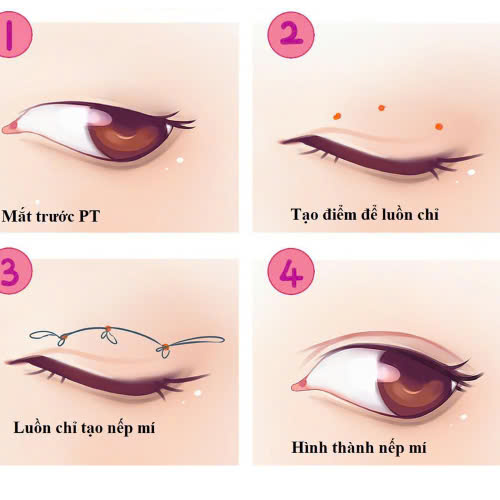 mi-mat-cuoi-khac-gi-mi-binh-thuong-va-vi-sao-duoc-yeu-thich