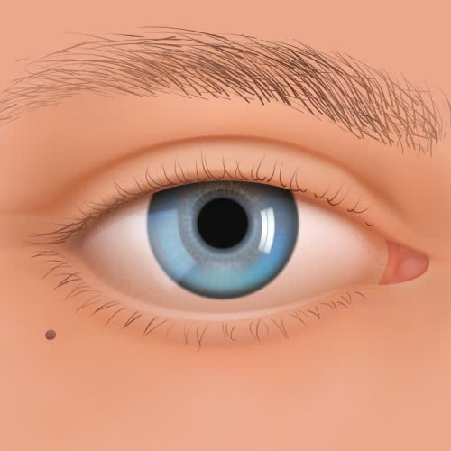 mi-mat-cuoi-khac-gi-mi-binh-thuong-va-vi-sao-duoc-yeu-thich