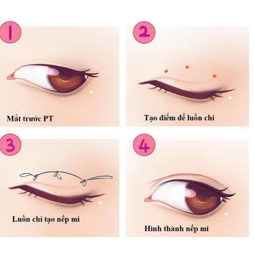 mi-mat-cuoi-la-gi-giai-dap-bi-quyet-so-huu-anh-mat-biet-cuoi-cuon-hut