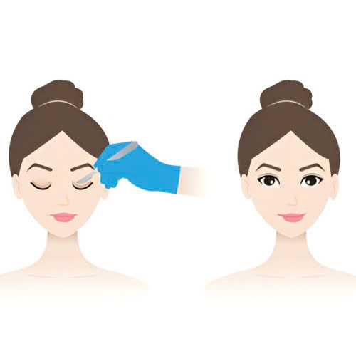 mi-mat-cuoi-la-gi-giai-dap-bi-quyet-so-huu-anh-mat-biet-cuoi-cuon-hut