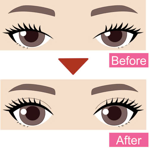 mi-mat-cuoi-la-gi-giai-dap-bi-quyet-so-huu-anh-mat-biet-cuoi-cuon-hut