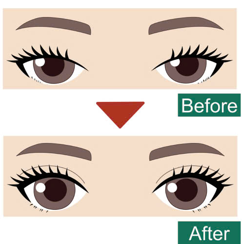 mi-mat-cuoi-tu-nhien-la-gi-tai-sao-mi-mat-cuoi-lai-duoc-cac-chi-em-uu-chuong-hien-nay