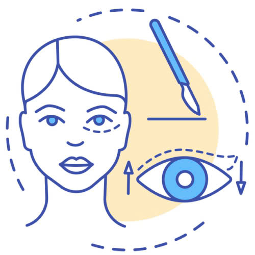 mo-goc-mat-ngoai-co-lam-thay-doi-tuong-so-khong-dep-hon-va-co-the-doi-van-hay-khong