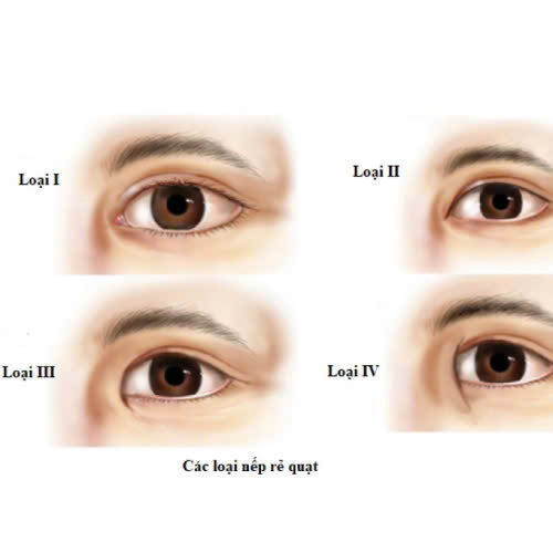 su-that-ve-mo-goc-mat-trong-cho-nam-gioi-hieu-dung-de-dep-dung-cach