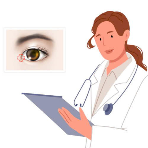 su-that-ve-mo-goc-mat-trong-cho-nam-gioi-hieu-dung-de-dep-dung-cach