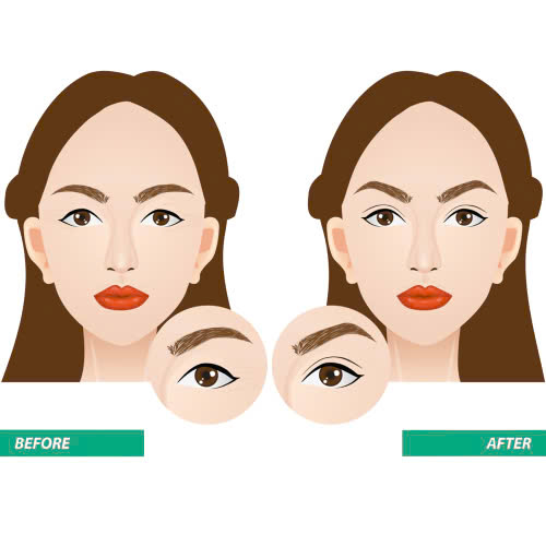 phau-thuat-mat-kieu-trung-hoa-co-dien-la-gi-giai-phap-giup-ban-so-huu-anh-mat-hut-hon-bi-an-sac-sao