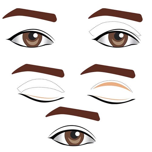 phau-thuat-tao-hinh-mat-trung-dong-giai-phap-de-so-huu-anh-mat-quyen-ru-va-cuon-hut