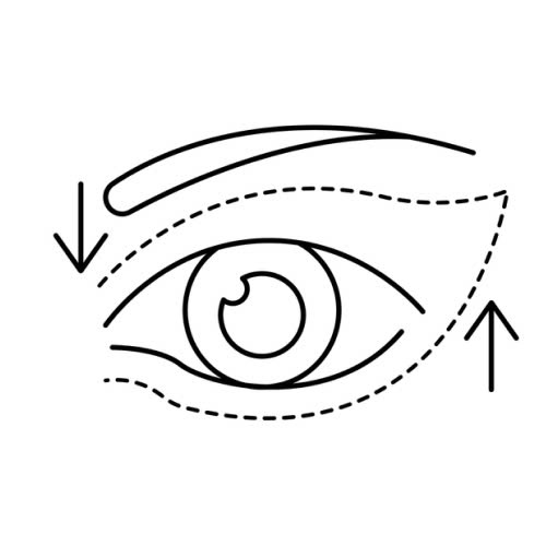 phau-thuat-tao-hinh-mat-trung-dong-giai-phap-de-so-huu-anh-mat-quyen-ru-va-cuon-hut