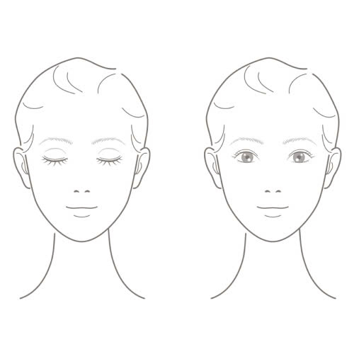 phau-thuat-tao-hinh-mat-trung-hoa-la-gi-cung-tim-hieu-ve-quy-trinh-uu-diem-va-nhung-ai-phu-hop-thuc-hien-phuong-phap-lam-dep-nay