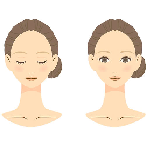 phau-thuat-tao-mi-mat-cuoi-la-gi-cung-tim-hieu-ve-quy-trinh-loi-ich-va-luu-y-khi-thuc-hien-phuong-phap-nay