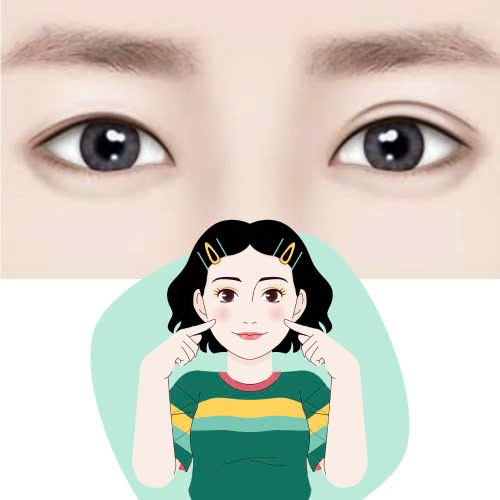 review-mi-mat-cuoi-nhung-dieu-ban-can-biet-truoc-khi-quyet-dinh-thuc-hien-phuong-phap-nay