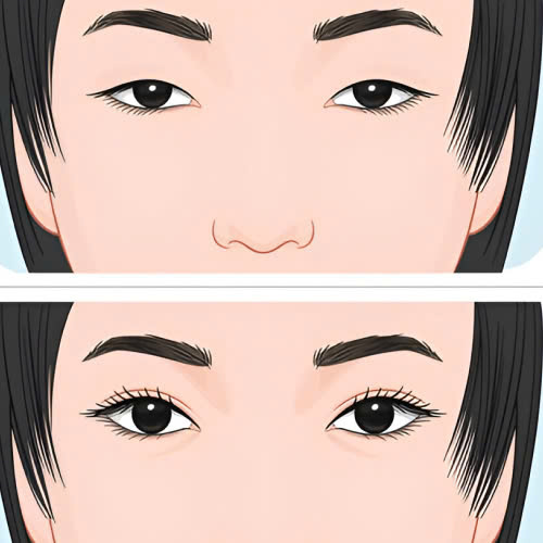 review-mi-mat-cuoi-nhung-dieu-ban-can-biet-truoc-khi-quyet-dinh-thuc-hien-phuong-phap-nay