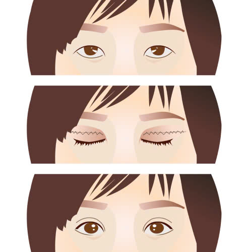 sua-mi-mat-kieu-trung-hoa-co-dep-khong-uu-va-nhuoc-diem-ban-can-biet