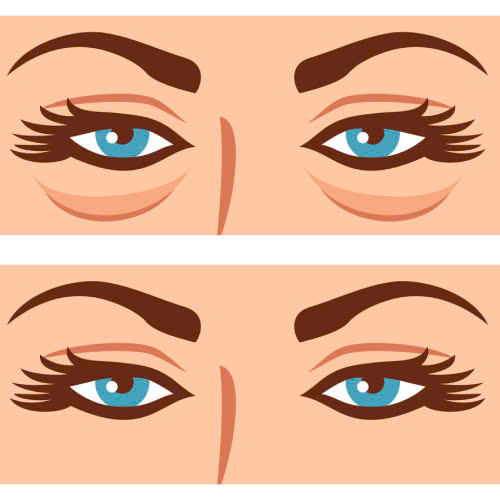 tao-hinh-mat-trung-dong-bi-hong-phai-lam-sao-nhung-buoc-xu-ly-dung-cach-khong-nen-bo-qua