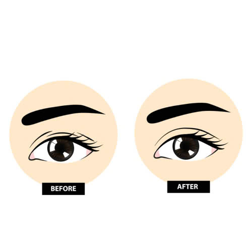 tao-hinh-mat-trung-dong-bi-hong-phai-lam-sao-nhung-buoc-xu-ly-dung-cach-khong-nen-bo-qua