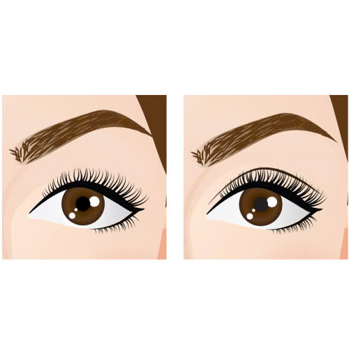 tao-hinh-mat-trung-dong-gia-bao-nhieu-nhung-dieu-can-biet-de-lua-chon-an-toan-hieu-qua