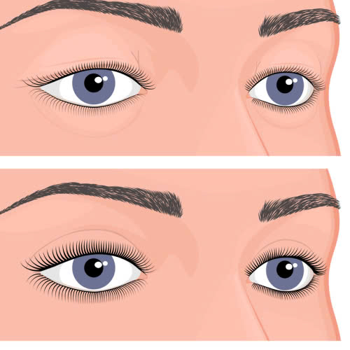 tao-hinh-mat-trung-dong-gia-bao-nhieu-nhung-dieu-can-biet-de-lua-chon-an-toan-hieu-qua