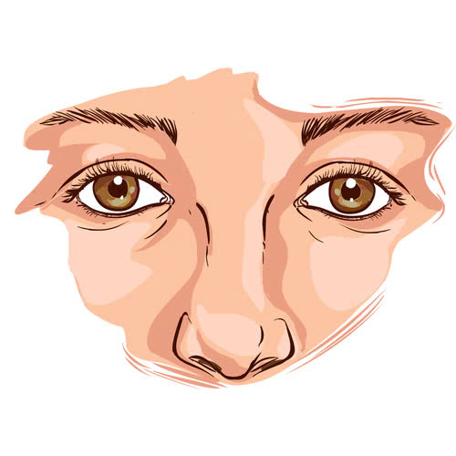 tao-hinh-mat-trung-dong-la-gi-bi-quyet-so-huu-doi-mat-sau-cuon-hut