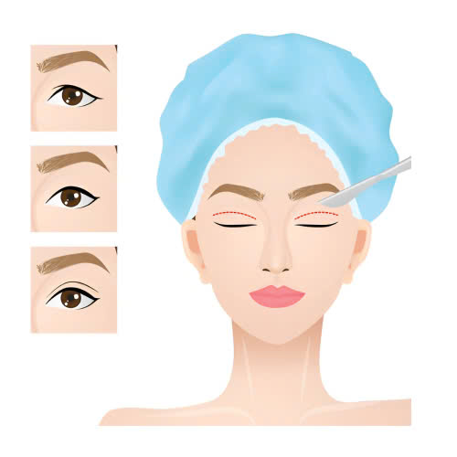 tao-hinh-mat-trung-hoa-bao-lau-thi-lanh-qua-trinh-hoi-phuc-va-cach-cham-soc-de-mat-nhanh-lanh