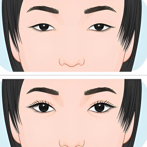 tao-hinh-mat-trung-hoa-la-gi-bi-quyet-so-huu-doi-mat-thanh-tu-quyen-ru-chuan-a-dong