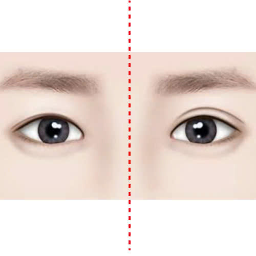 tao-hinh-mat-trung-hoa-la-gi-bi-quyet-so-huu-doi-mat-thanh-tu-quyen-ru-chuan-a-dong