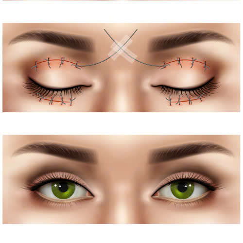 tao-hinh-mi-mat-kieu-tay-xu-huong-lam-dep-giup-doi-mat-sac-net-va-cuon-hut-hon