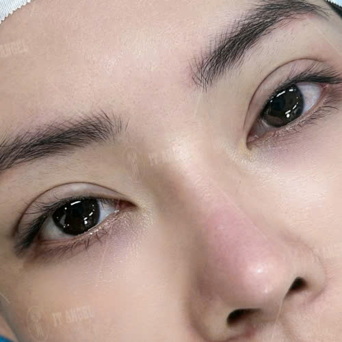 tao-hinh-mi-mat-trung-hoa-la-gi-cung-tim-hieu-ve-quy-trinh-luu-y-va-uu-diem-khi-thuc-hien-dich-vu-lam-dep-nay