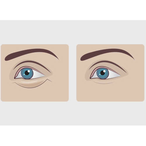 tao-hinh-mi-mat-trung-hoa-la-gi-cung-tim-hieu-ve-quy-trinh-luu-y-va-uu-diem-khi-thuc-hien-dich-vu-lam-dep-nay