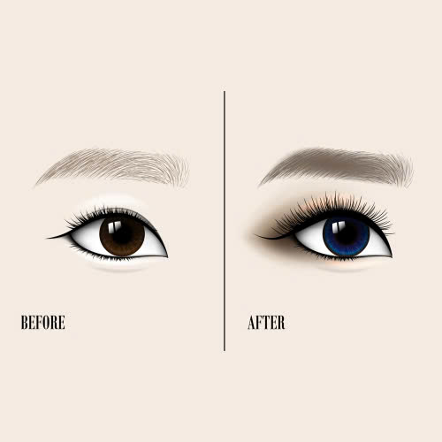 tao-mi-mat-cuoi-gia-bao-nhieu-nhung-luu-y-ve-gia-khi-chon-co-so-tham-my-de-quyet-dinh-lot-xac-doi-mat