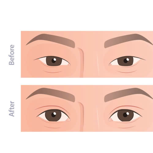 tao-mi-mat-cuoi-ket-hop-cat-mi-phuong-phap-giup-doi-mat-ban-tro-nen-tuoi-tan-tre-trung-rang-ro-tu-nhien